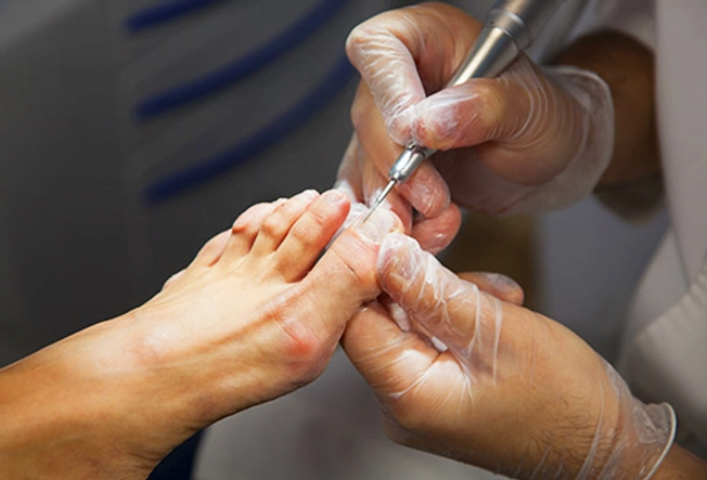 terracalm nai treatment