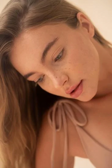 age spots on face woman with freckles